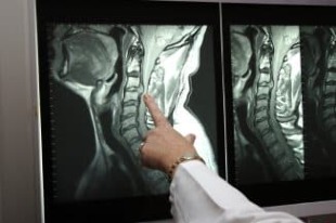 Kaela röntgenograafia